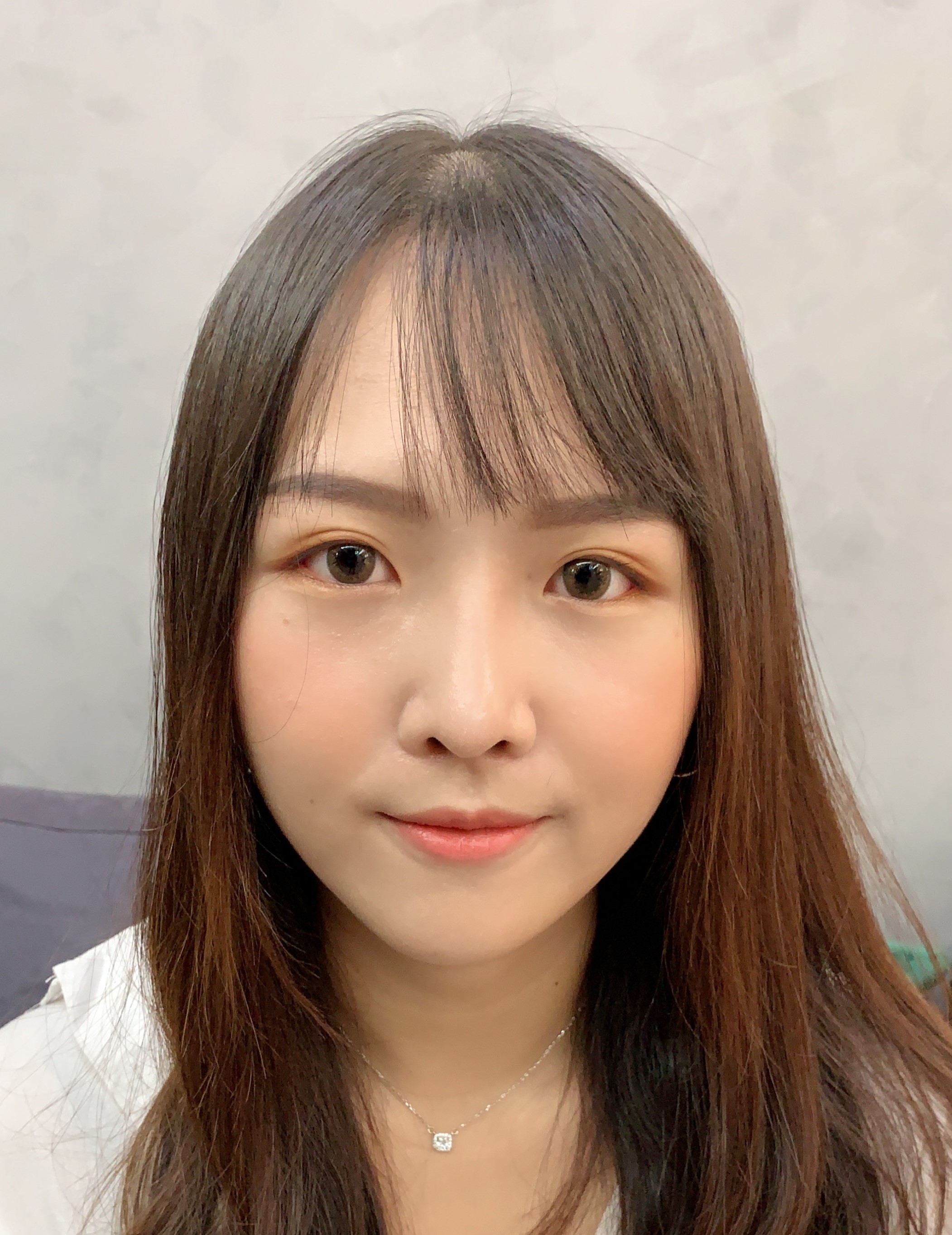 用鼻子襯托出美麗的臉龐 視覺上五官的精緻蛻變