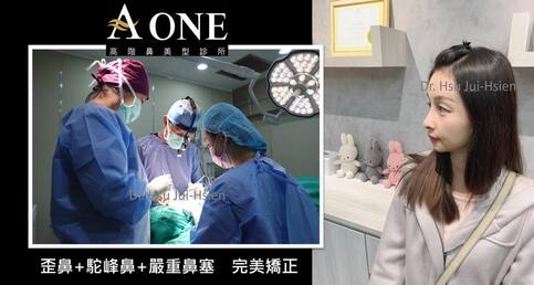 一次解決歪鼻、鷹鈎駝峰鼻、嚴重鼻塞三大問題！