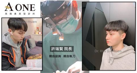 韓國歐巴鼻型分析&男性隆鼻案例分享