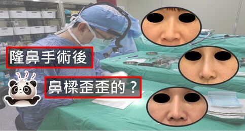 二次重修手術 - 隆鼻後鼻樑歪歪的？